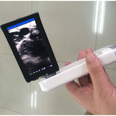 XProbe系列带屏无线探头式B超掌上超声迷你超声_简介