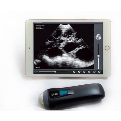 UProbe-1扇扫探头式B超无线超声掌上超声迷你超_简介