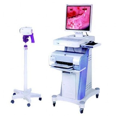 电子阴道镜数字成像系统SD-300D型_简介