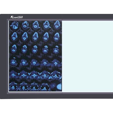 LED观片灯_简介