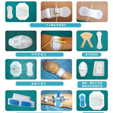 体表导管固定装置_简介
