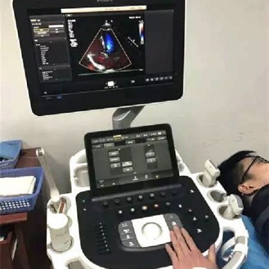 飞利浦Affiniti 70妇产科应用四维彩超_简介