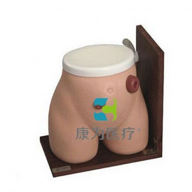 瘘管造口术护理模型_简介