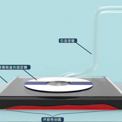 负压封闭引流护创材料_简介