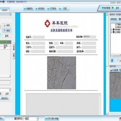 皮肤真菌检测系统_简介