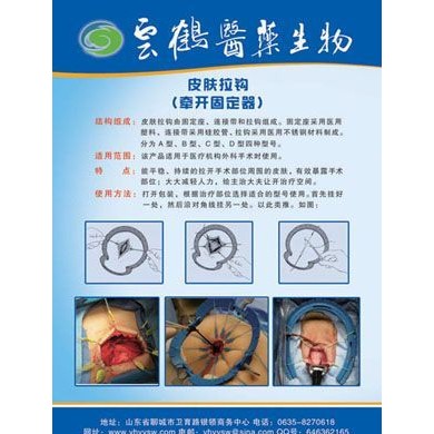 皮肤拉钩（牵开固定器）_简介
