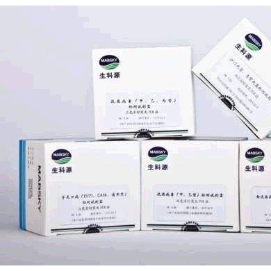 禽流感病毒专项检测试剂盒（实时荧光PCR法）_简介
