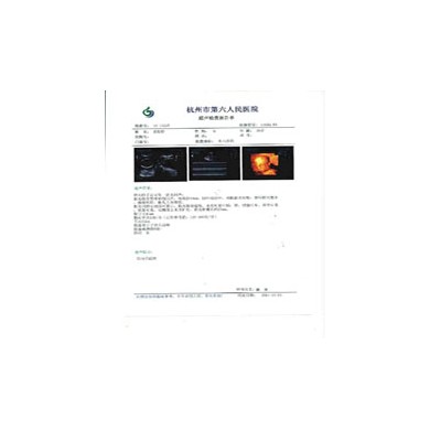 JZ高清医用胶片_简介