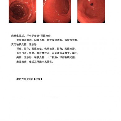 MPET 医用B超胶片，彩超胶片_简介