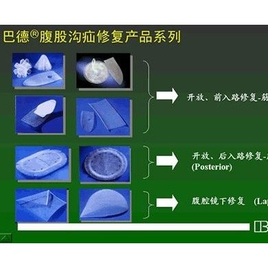 巴德BARD疝修补片网塞_简介