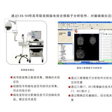 脑外科癫痫手术定位系统_简介