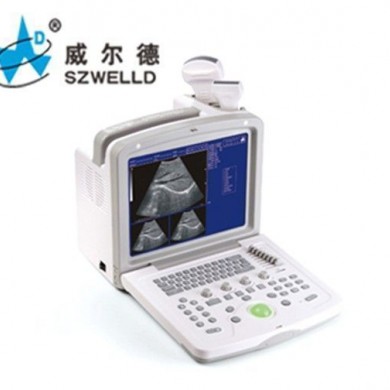数字便携式b超_简介