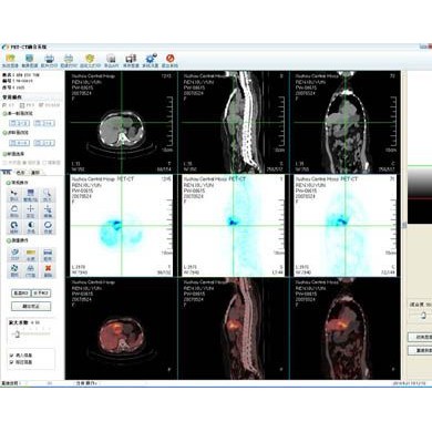 PET-CT-MR中心融合处理软件中文报告系统_简介