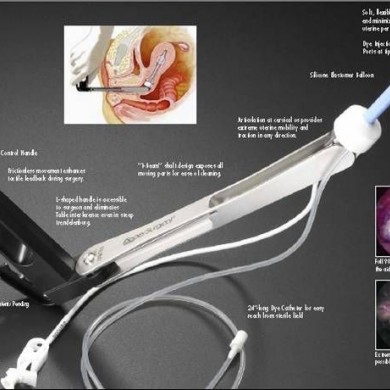 美国Coopersurgical 举宫器_简介