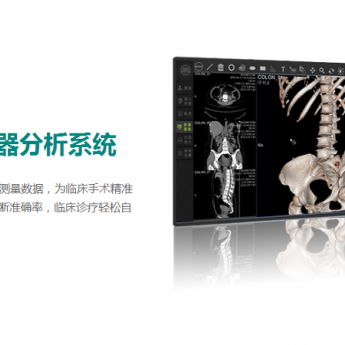 三维重建脏器分析系统_简介