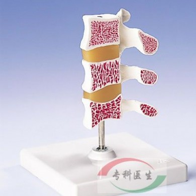 骨质疏松症模型_简介