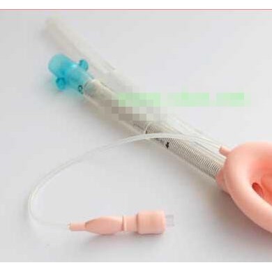 医用喉罩_简介