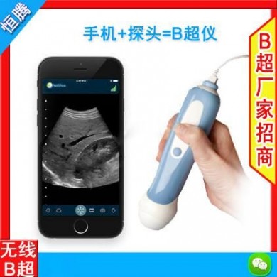 四维彩超机_简介